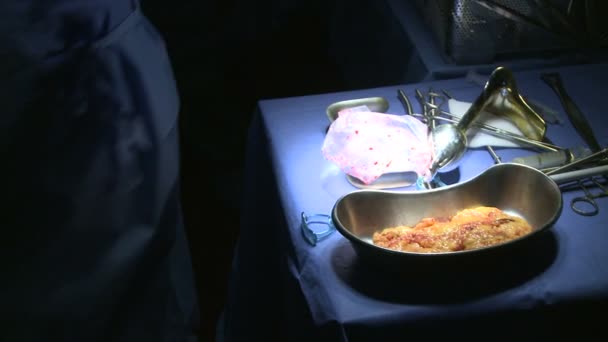 Robotic excision of the uterus — Stock Video