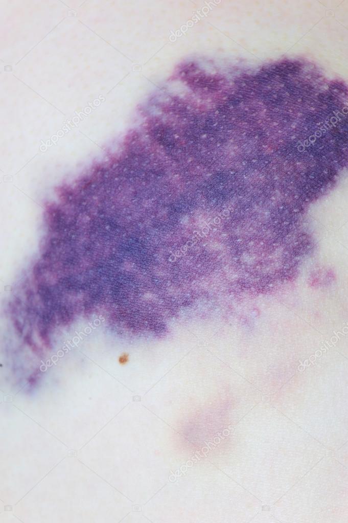 сетчатка филина микрофотография. фиолетовая эмоция. фиолетовый цвет в психологии. фиолетовые кровоподтеки. американец пауль карасон.