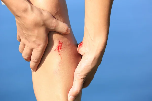 Woman holding sports injured leg — Stock Photo, Image