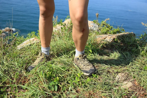 女人的徒步旅行者双腿 — 图库照片