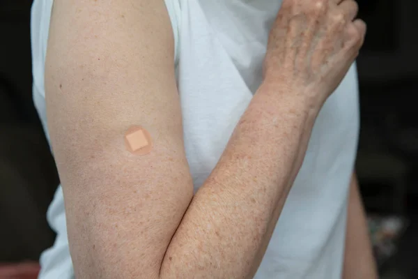 Mulher caucasiana com gesso no braço após uma injeção de vacinação — Fotografia de Stock