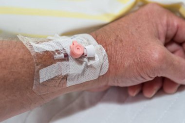 Venflon, kolla sarılmış venöz kateter - infüzyon için kanül