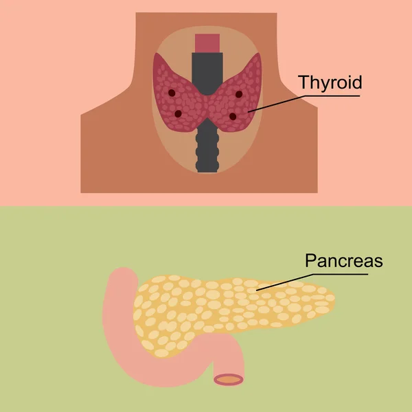 Endokrin sistem komplikasyonlar şeker hastalığı — Stok Vektör