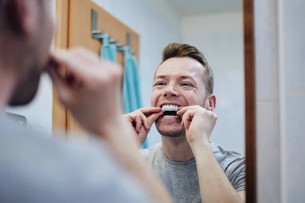 Jovem Preparando Bandeja Silício Para Clareamento Dos Dentes Com Gel — Fotografia de Stock