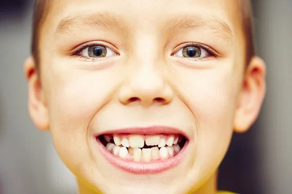 Teeth — Stock Photo, Image