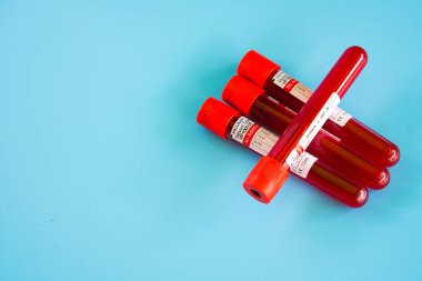 Kelantan, Malezya - 13.02.2021: Mavi zemin üzerinde kan örneği bulunan test tüpü.