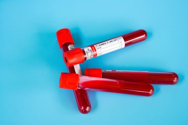 Kelantan, Malezya - 13.02.2021: Mavi zemin üzerinde kan örneği bulunan test tüpü.