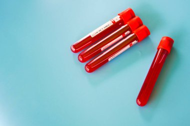 Kelantan, Malezya - 13.02.2021: Mavi zemin üzerinde kan örneği bulunan test tüpü.