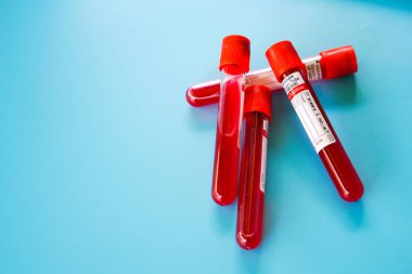 Kelantan, Malezya - 13.02.2021: Mavi zemin üzerinde kan örneği bulunan test tüpü.