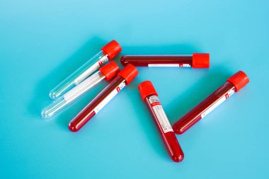 Kelantan, Malezya - 13.02.2021: Mavi zemin üzerinde kan örneği bulunan test tüpü.