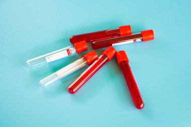 Kelantan, Malezya - 13.02.2021: Mavi zemin üzerinde kan örneği bulunan test tüpü.