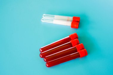 Kelantan, Malezya - 13.02.2021: Mavi zemin üzerinde kan örneği bulunan test tüpü.