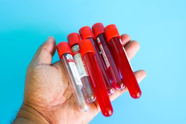 Kelantan, Malezya - 13.02.2021: Mavi zemin üzerinde kan örneği bulunan test tüpü.