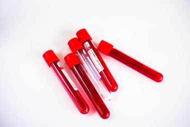 Kelantan Malezya - 13.02.2021: Beyaz arka planda tüp kan örneği.