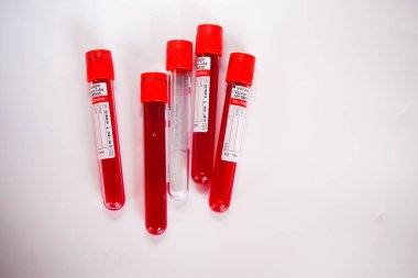 Kelantan Malezya - 13.02.2021: Beyaz arka planda tüp kan örneği.