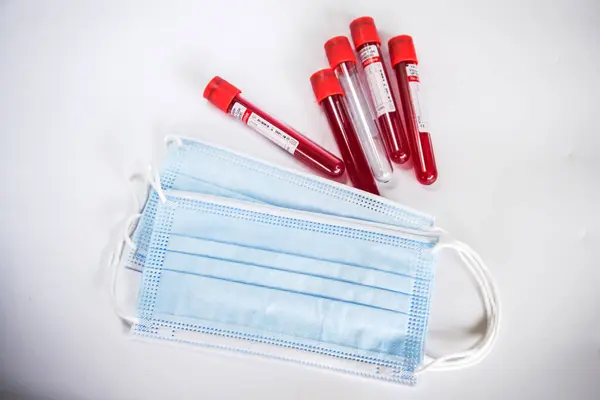Kelantan, Maaysia - 13.02.2021: Mavi arka planda kan örneği ve yüz maskesi olan test tüpü.
