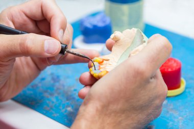 Diş teknisyeni bir balmumu köprü modelleme