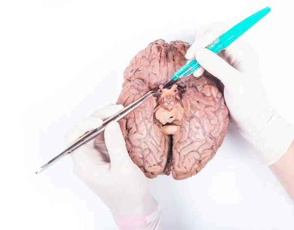 Human brain dissection — Stock Photo, Image