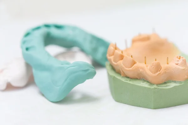 Модель литья зубов и силиконовый лоток — стоковое фото