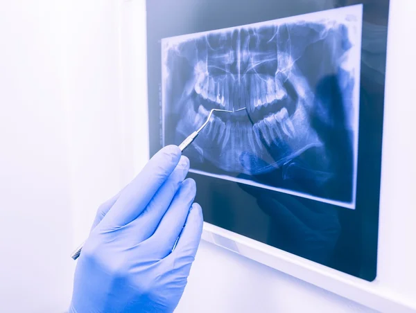 Doctor explicando rayos X dentales — Foto de Stock