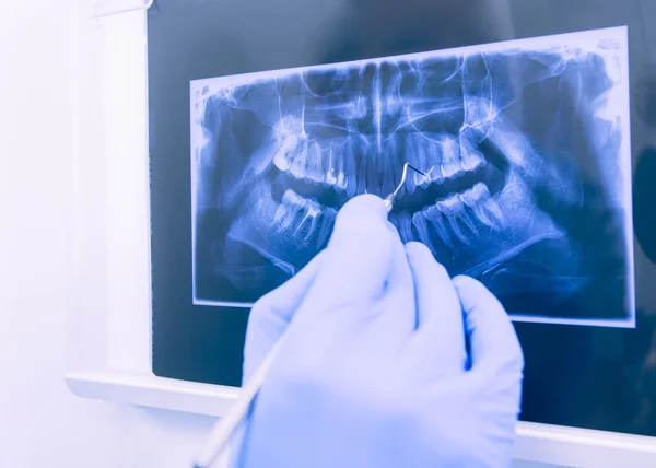 Panoramautsikt över dental xray — Stockfoto