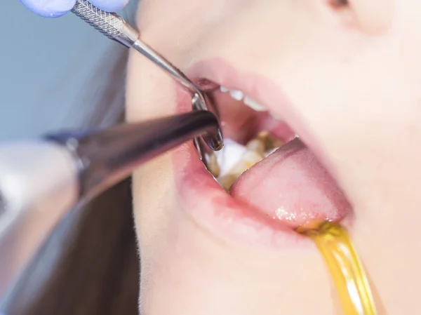 Higiene dentária da mulher — Fotografia de Stock