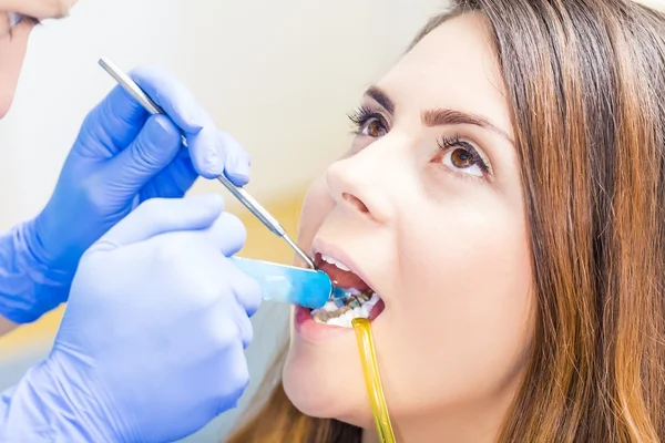 Higiene dental de la mujer — Foto de Stock