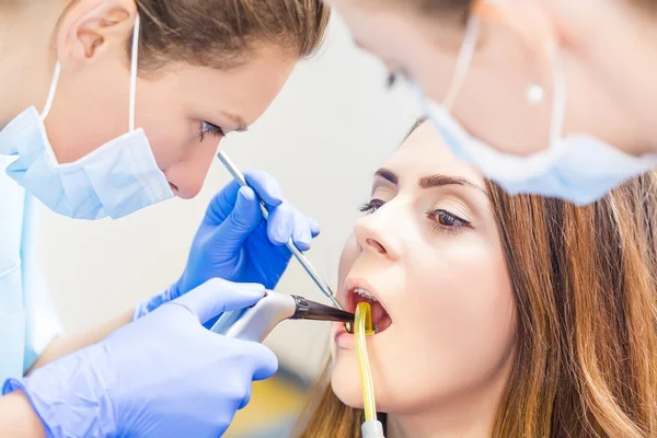 Dental fyllning förfarande — Stockfoto