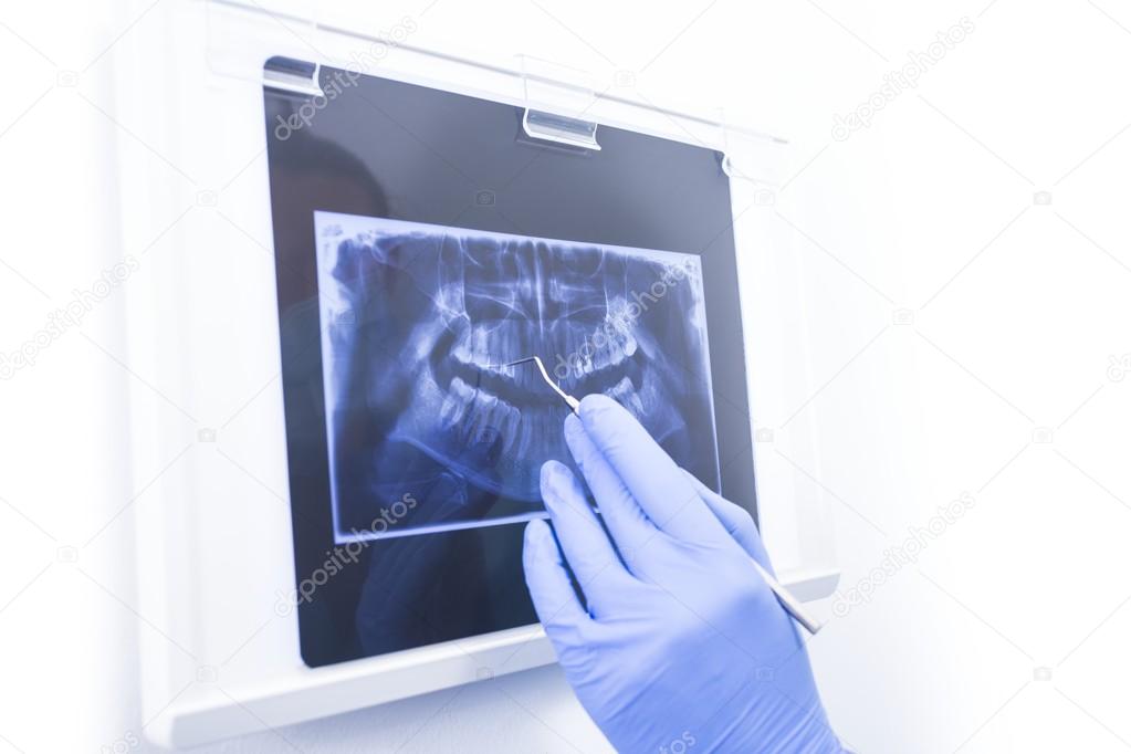 Panoramic dental xray