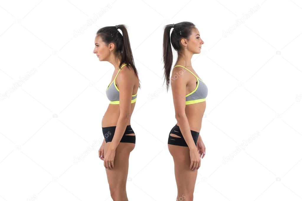 Woman with impaired posture 