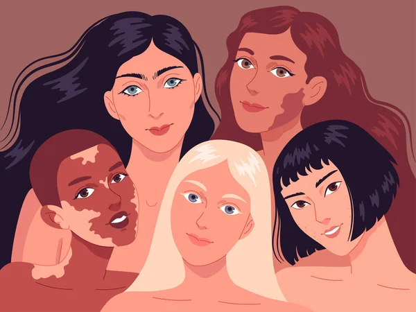 Retrato de mujeres jóvenes con diferentes tipos de piel. — Vector de stock