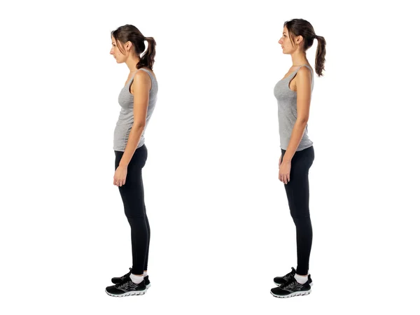 Woman with impaired posture position defect scoliosis and ideal bearing — Stock Photo, Image