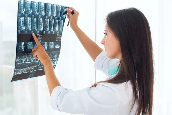 Woman doctor in hospital looking at x-ray film healthcare, roentgen, people and medicine concept. — Stock Photo, Image