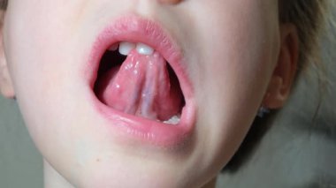 7 yaşındaki bir kız süt dişini diliyle hareket ettiriyor. Gevşek süt dişiyle ağzını kapat. Kız gevşek süt dişine dille bastırıyor. Süt dişlerini kaybetme kavramı. Diş bakımı.