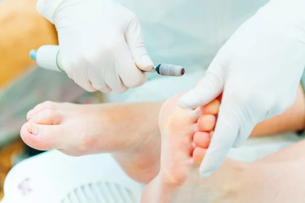 Pedicure in proces close-up — Stockfoto