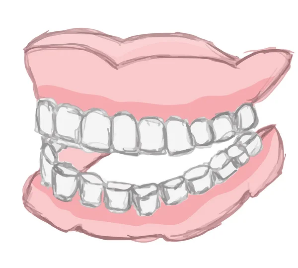 Dientes Postizos Humanos Dentadura Acrílica Permanente Bosquejo Prótesis Postiza — Archivo Imágenes Vectoriales