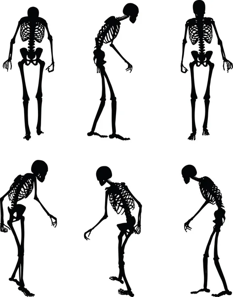 Skeleton silhouet in oude lopen pose — Stockvector