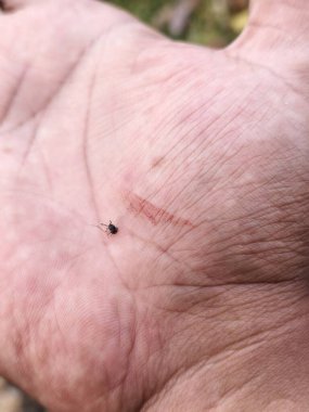 Ezildikten sonra elinde kanayan bir sivrisineğin fotoğrafı.