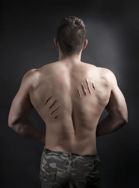 Sexy Male Body with Scratches from nails on his Back. — Stock Photo, Image