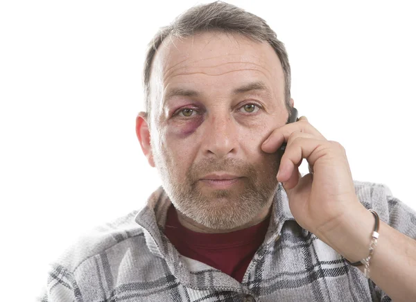 Белый мужчина средних лет Эмоциональный портрет с настоящим ушибом — стоковое фото