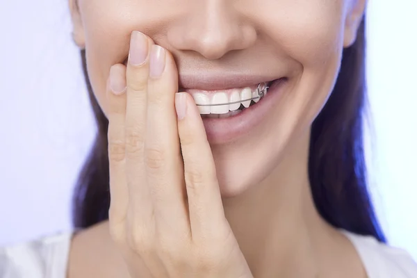 Retrato de bela menina sorridente cobrindo seu retentor para T — Fotografia de Stock