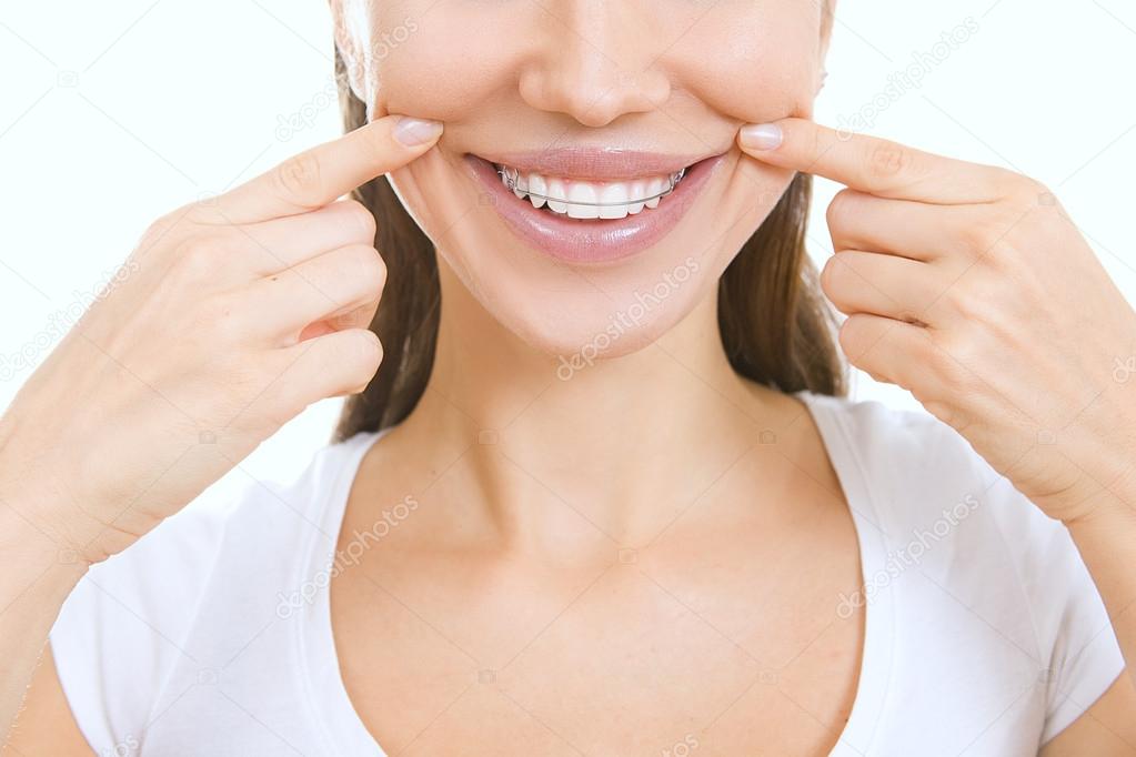 Beautiful smiling girl with retainer for teeth pointing at her s