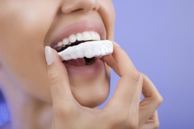 Teeth Whitening - Smiling girl with Tooth Tray, Close-up  clipart