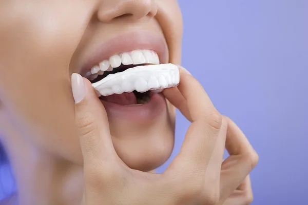 Tänder Whitening - ler flickan med tand bricka, närbild — Stockfoto