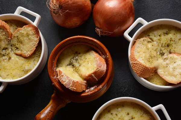 Sopa Cebola Francesa Com Pão Torrado Queijo Cheddar — Fotografia de Stock