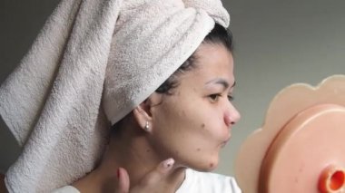 Kafasında havluyla üzgün bir kadın aynaya bakar ve cilt sorunu yüzünden stresli hisseder, endişeli bir kadın dokunuşu yüzünden sinirli siyah nokta sivilcesinden rahatsız olur.