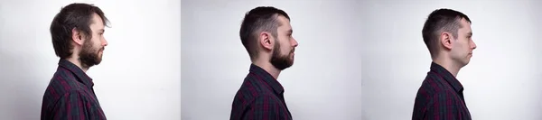 Schöner Mann Nach Oder Vor Der Rasur Collage Von Menschenporträt — Stockfoto