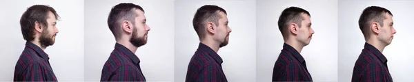 Hombre guapo después o antes de afeitarse. Collage del retrato del hombre. Ejemplo de cambio de la cara dependiendo de la cantidad de pelo en la cara. —  Fotos de Stock