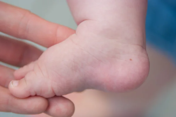 Child leg — Stock Photo, Image