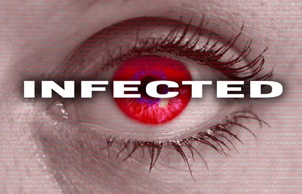 Infected eye looks at viewer concept macro — Stock Photo, Image